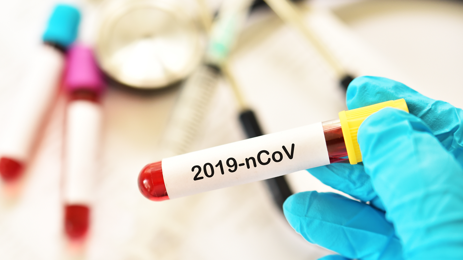 detetar coronavirus